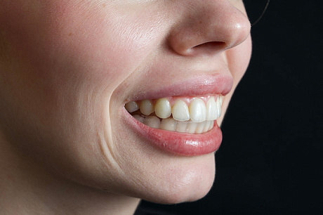 Капа для фитнеса и тяжелой атлетики